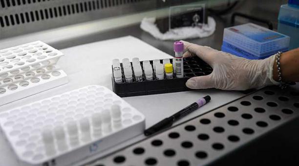 UDLA procesará pruebas PCR en Quito y contribuye con Ikiam para diagnosticar COVID-19 en la región amazónica